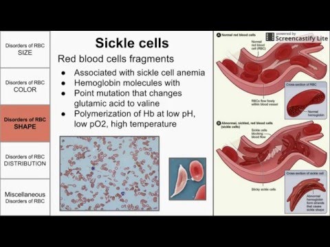 Red Blood Cell Morphological Abnormalities