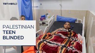 Video: 15-year old Palestinian boy left blind after being shot by Israeli soldiers | TRT World