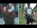 World S Fattest Boy Loses 167 Pounds
