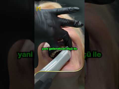 Ağıziçi Tarayıcı ile Ölçü Alımının Avantajları