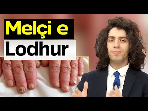 Ndiqni këto KËSHILLA/ MYKU i thonjve - Shkaqet dhe si mund ta eleminojmë