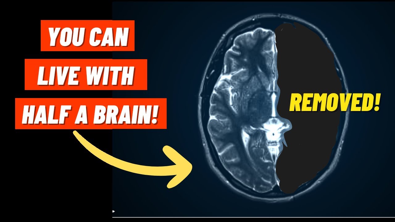 How can the Brain RECOVER from Trauma? | Brain Plasticity & Functional Recovery