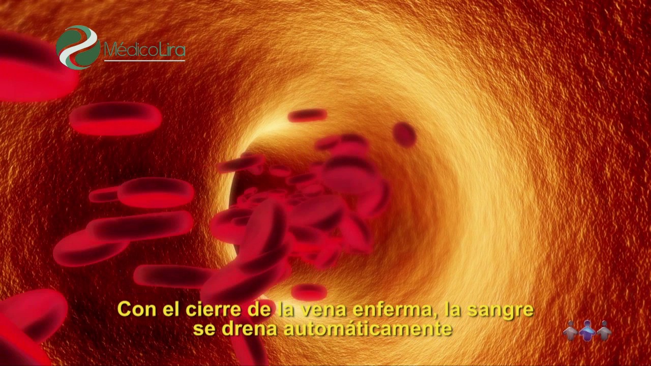 Luis Fernando Lira Menendez-23