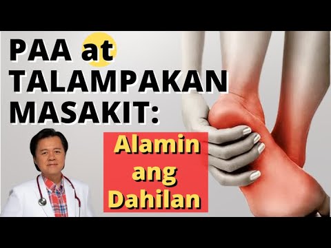 Paa at Talampakan Masakit: Alamin ang Dahilan - Payo ni Doc Willie Ong #1331