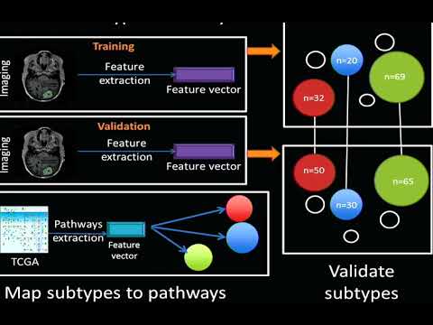 8th Annual TMII Symposium – 2018 – Session IV – Cancer & Body Imaging – Olivier Gevaert, PhD