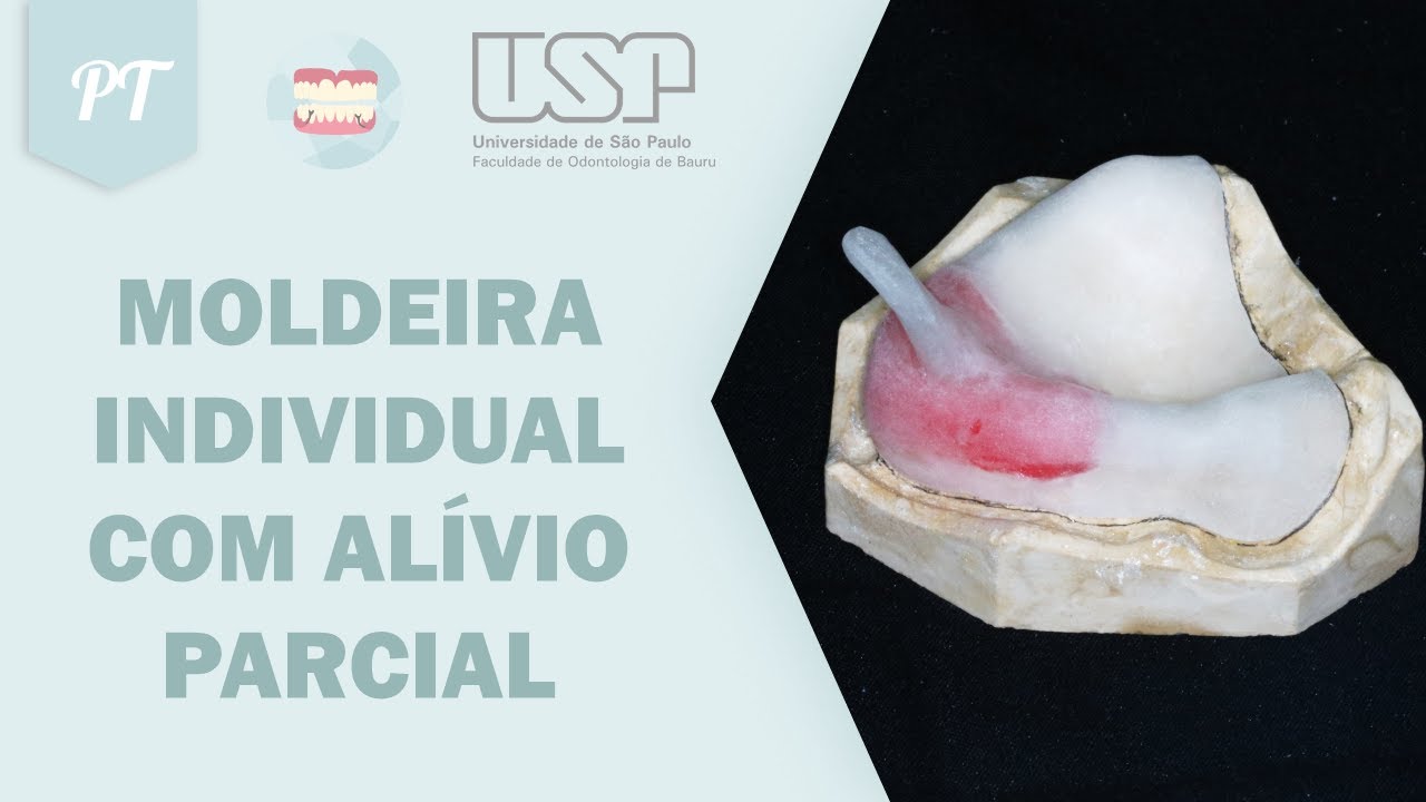 Moldeira individual com alívio parcial (PT)