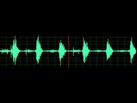 Crackles- Pulmonary Edema