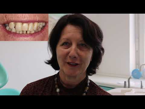 Zahnkorrektur in jedem Alter - es ist nie zu spät für gerade Zähne und ein gewinnendes Lächeln.