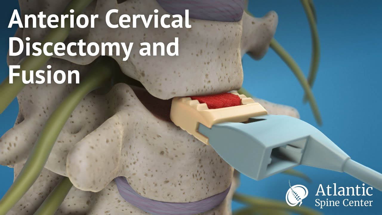 Daniele Millimaggi-29