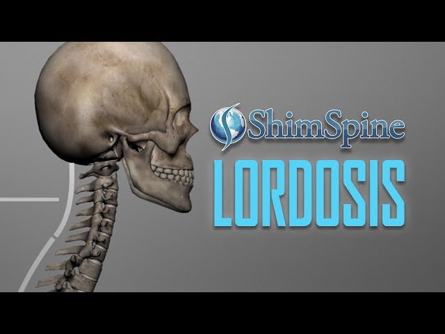 Video Pronunciation of lordosis in English