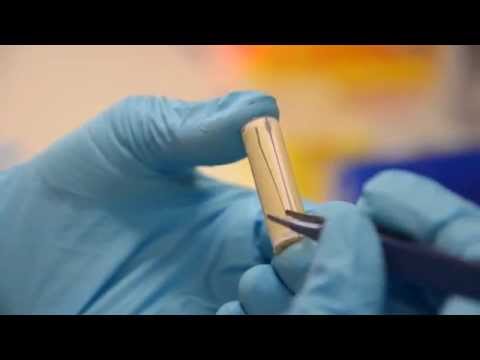 DNA Extraktion: Wie funktioniert das?