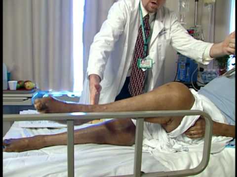 Stroke Scale Certification Group B Patient 4