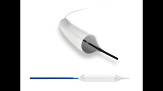 La dilatazione uretrale mediante Optilume: La procedura chirurgica