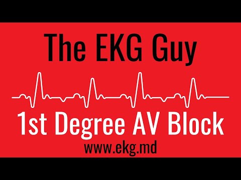 First Degree AV Block EKG l The EKG Guy - www.ekg.md