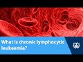 What Is Chronic Lymphocytic Leukaemia