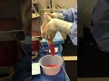 Fat Grafting Nina S Naidu MD FACS NYC Plastic Surgeon