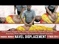 Navel Displacement Constipation Gas And Acidity Abdominal Pain And Swelling Get Fastest Relief