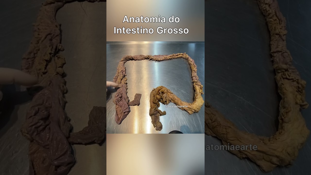 Divisão anatômica do intestino grosso #anatomia #anatomiapratica #anatomiaearte