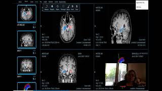 Introducing Neuroshieldu2122 and In-Med Prognostics