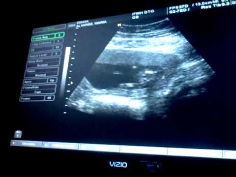 Confirmation...YEP, it's a Hoo-Hah