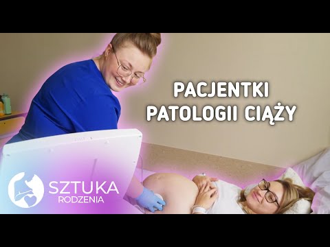 KTO TRAFIA NA ODDZIAŁ PATOLOGII CIĄŻY?🤰| Sztuka rodzenia