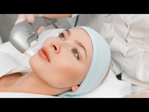 Алена Шишкова и процедура смас лифтинг на аппарате Ультраформер в Venesa Clinic