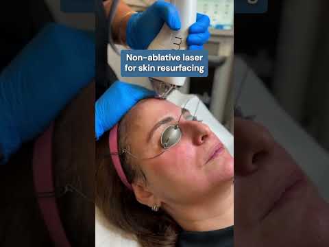 Discover the new laser treatment MOXI ⚡ #moxilaser #medispa #montreal #facialtreatment