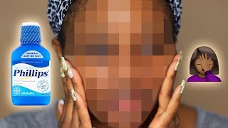 I PUT MILK OF MAGNESIA ON MY FACE FOR 5 YEARS.  This is what happened.