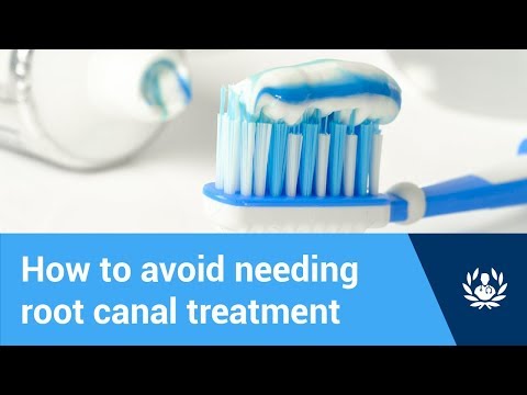 3rd YouTube video about how to avoid root canal