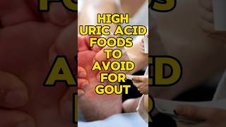 Download lagu High uric acid foods to avoid gout#shorts#health mp3