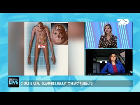 Gjysmë-njerëz dhe gjysmë-robot, njeriu i 2060 është i çuditshëm - Shqipëria Live