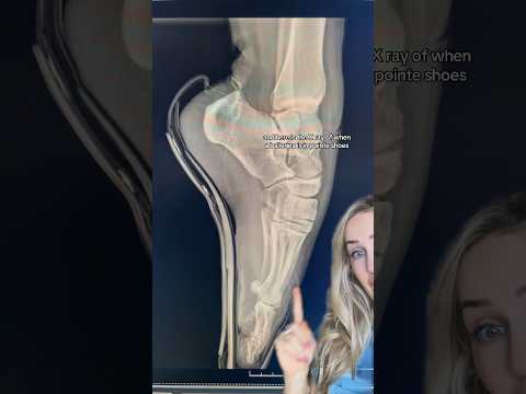 Why ballet is harder than it looks 😳