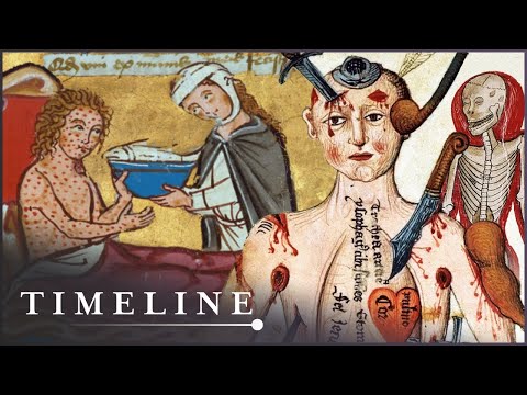 The Most Gruesome Diseases Of The Middle Ages