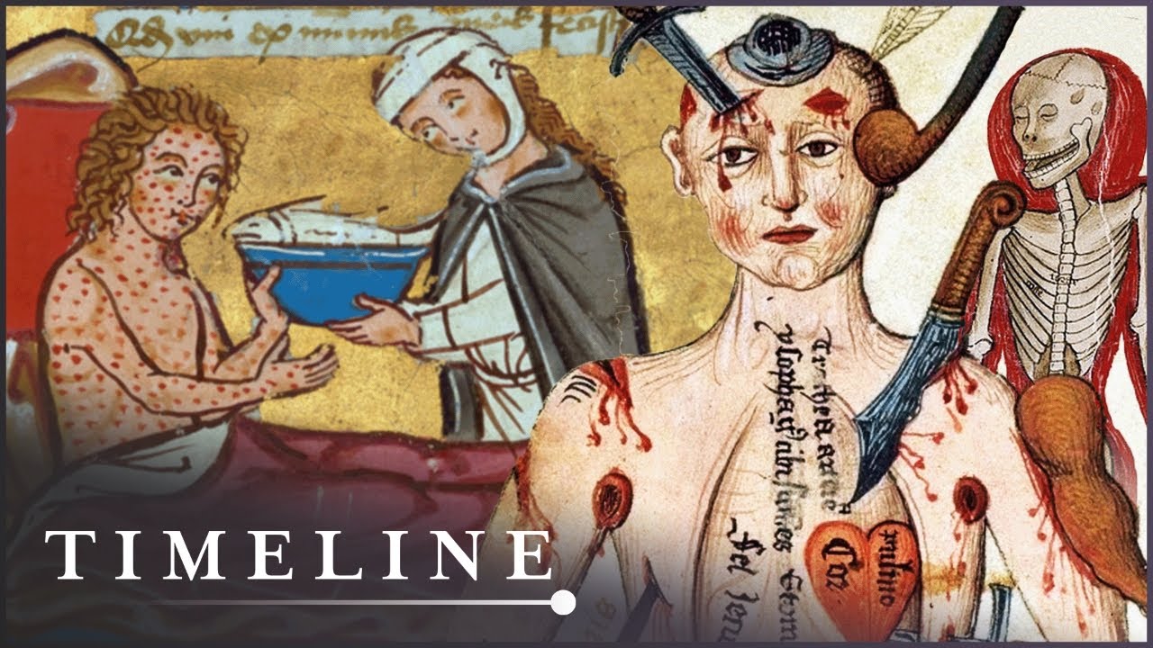 The Most Gruesome Diseases Of The Middle Ages