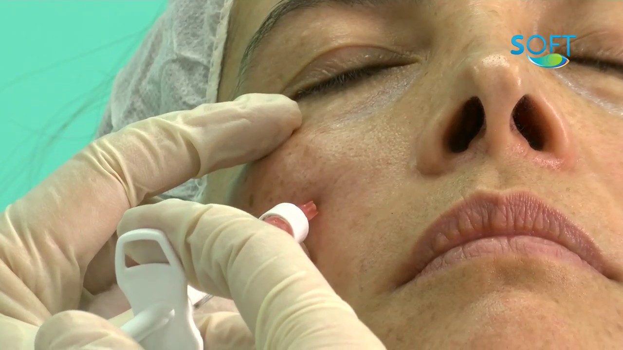 Juan Antonio Troyano Rivas-8