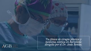 Operación de Mastopexia Sin Implante