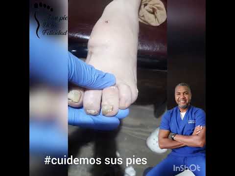#cuidemos la salud de sus piesa# adultos mayores.... casilda, Santa Fe.