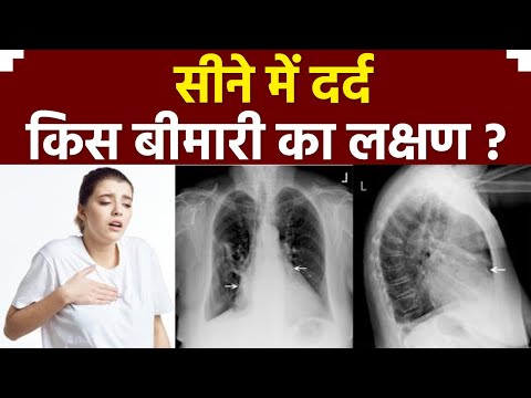 सीने में दर्द किस बीमारी का लक्षण | Seene Me Dard Kis Bimari Ka Lakshan | Boldsky *Health