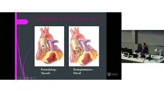 Should We Be Repairing More Aortic Valves – A/Prof George Matalanis