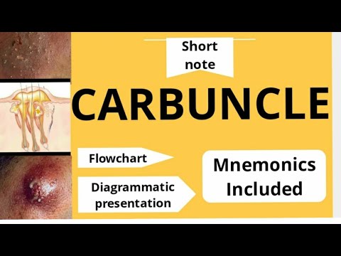 Carbuncle|Detailed explanation with mnemonics|General surgery|Third year|BDS|Bibliodent