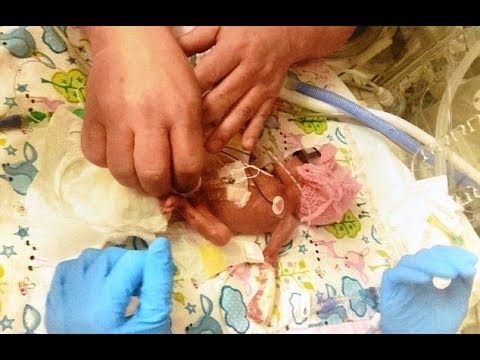 Fille née de la taille d'une tasse à café quitte l'hôpital après un combat de survie miraculeux Video
