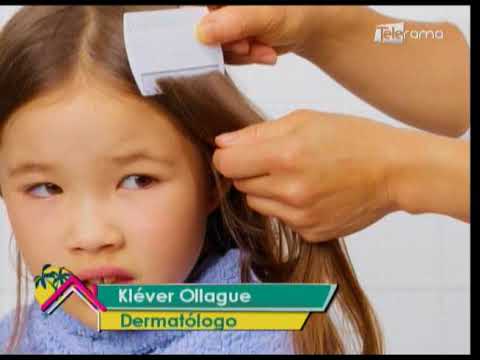 Piojos, problema de salud en el regreso a clases