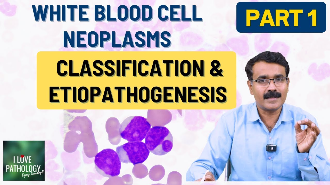 White Blood Cell Neoplasms  – Part 1: Classification & Etiopathogenesis