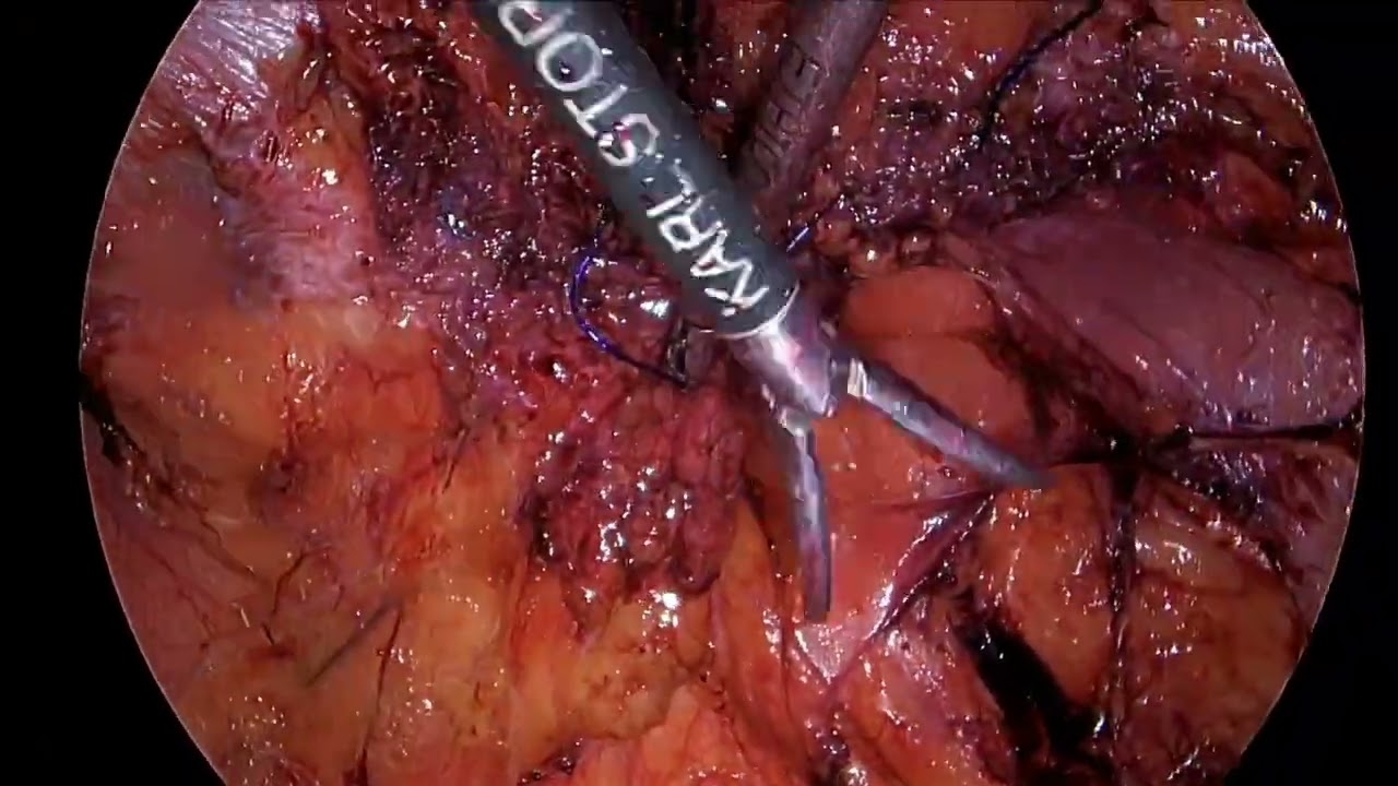 Juan Orlando Guaman-5