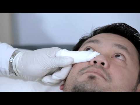 Proper Eye drop Instillation