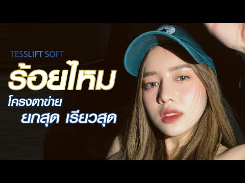 ร้อยไหม หน้าเรียว