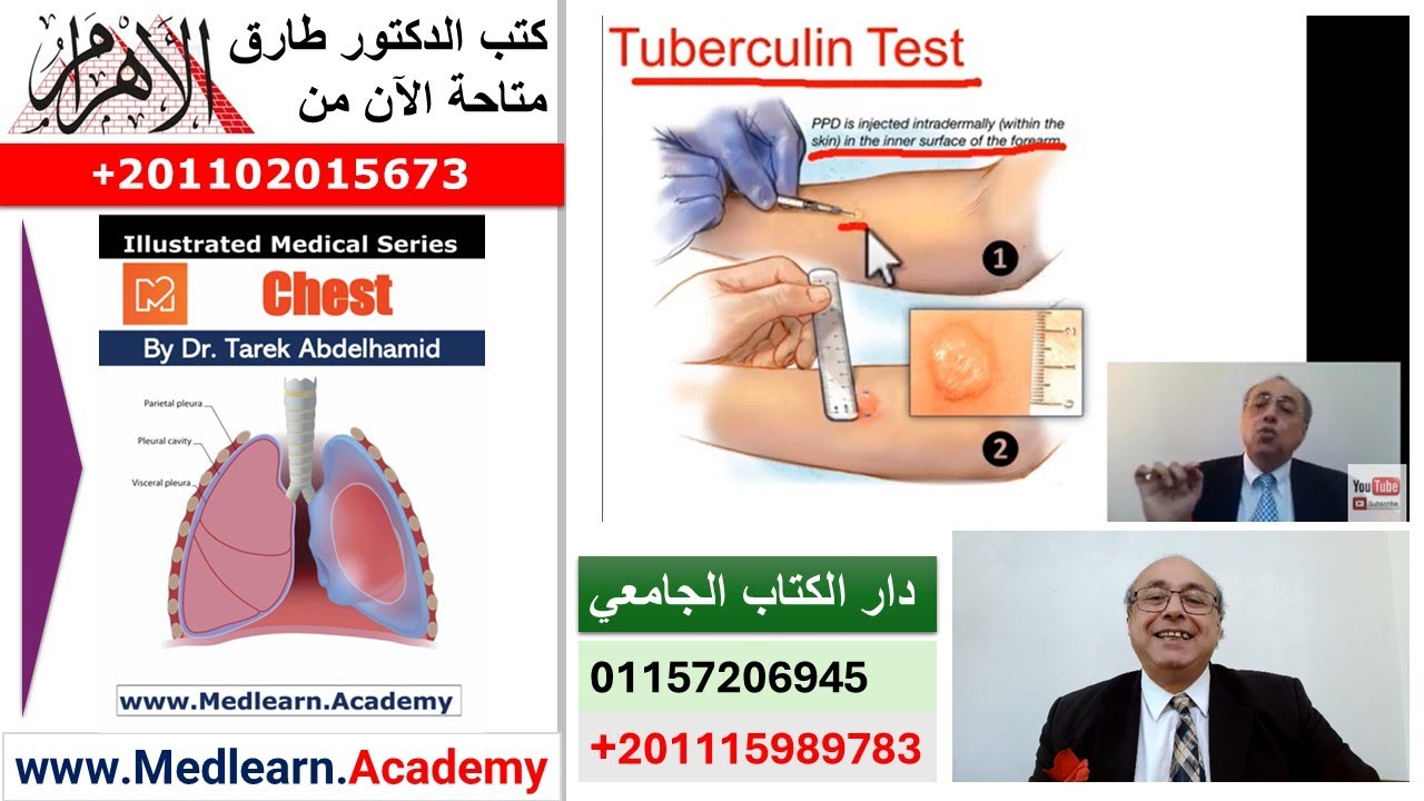 Tuberculosis (III)   #cme #internal_medicine #medical #usmle #محاضرات_باطنة #medicalstudent