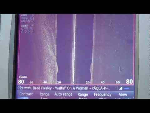 Lowrance StructureScan HD