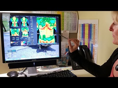 How A Thermography Scan Can Detect A Disease Before It Forms