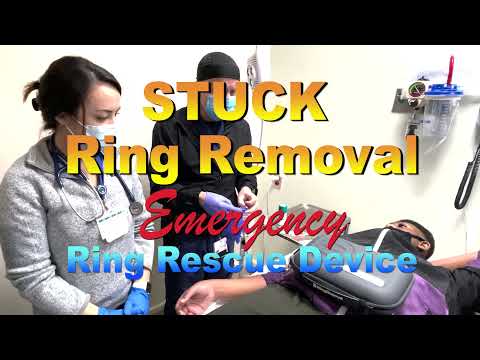 STUCK Ring Removal Emergency